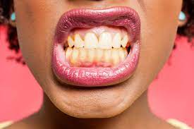 Oralcarepro - beneficii - cum se ia - reactii adverse - pareri negative